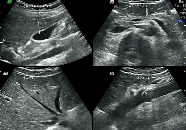 Abdominal Ultrasound in London - Ultrasound Services