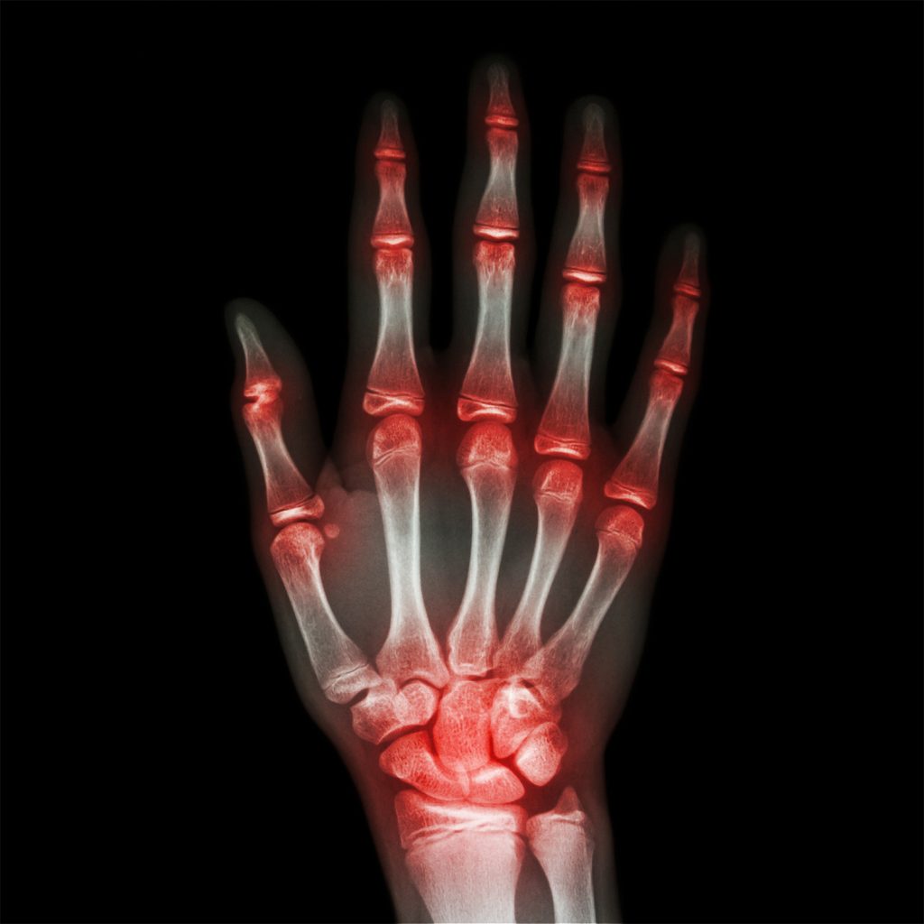 Musculoskeletal scans - Ultrasound Services