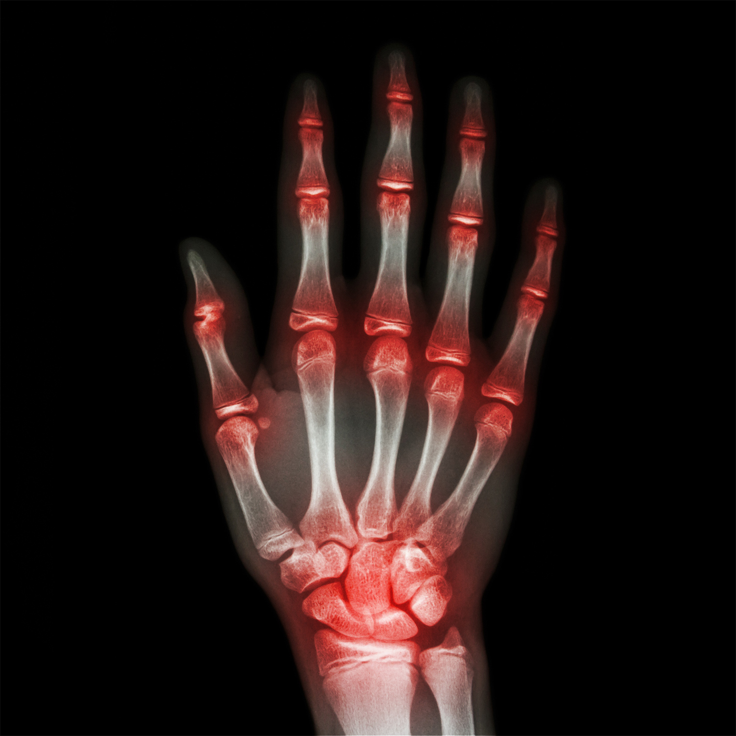 Musculoskeletal hand and wrist