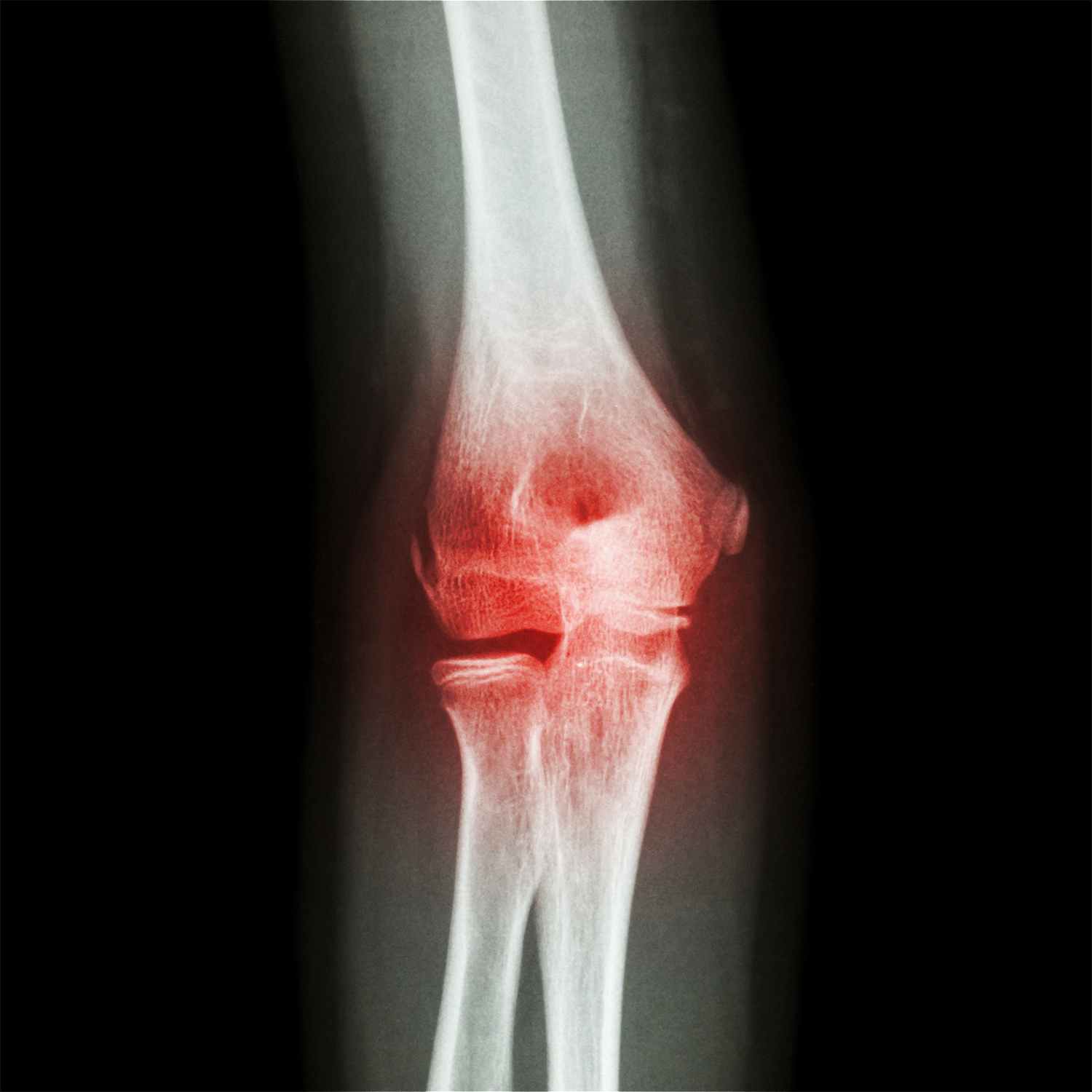 Musculoskeletal Knee
